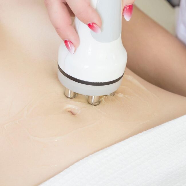 Cellulite Treatment in Dubai