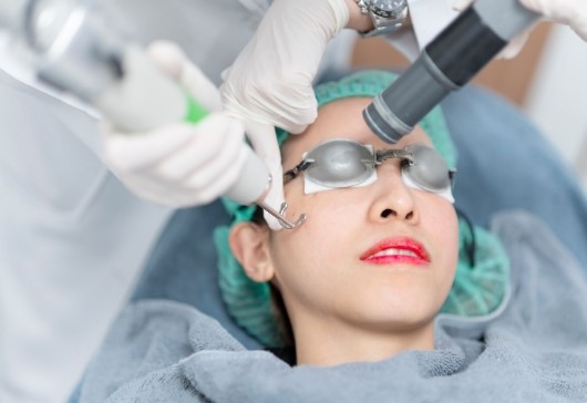 Pico Laser Treatment | Tattoo Removal in Dubai | Stretch Marks Removal