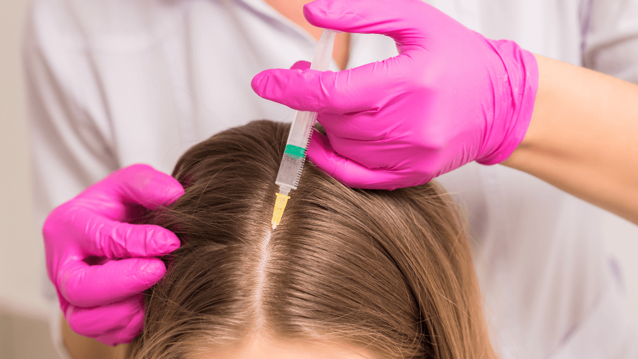 Exosome Therapy for Hair Loss in Dubai at Bionix Clinic