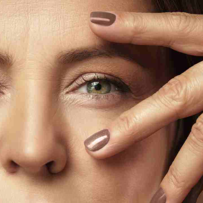 Transform Your Skin with Fine Lines Removal Treatment in Dubai
