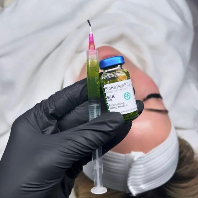 Bio Repeel – The Softer Chemical Peel