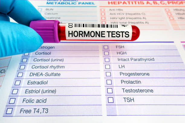 Hormone Test