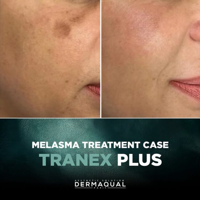 Your solution for bright skin
