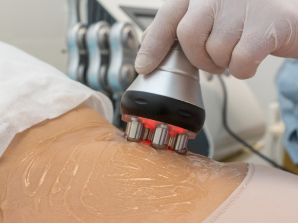 Non-Surgical Fat Reduction