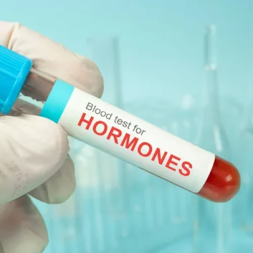Hormone Test